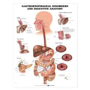 Gastroesophageal Disorders and Digestive Anatomy Chart  