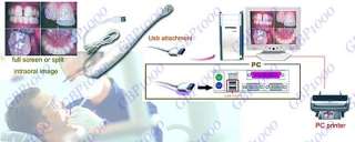 Intraoral Intra Oral Dental Camera USB Imaging System  