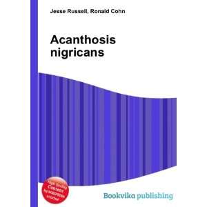 Acanthosis nigricans