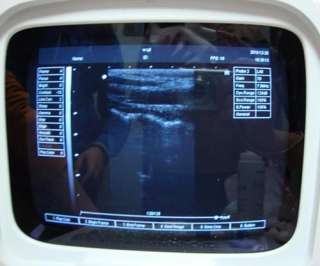 Full Digital Portable Ultrasound Scanner (PC Function) + FREE 3 Probes 